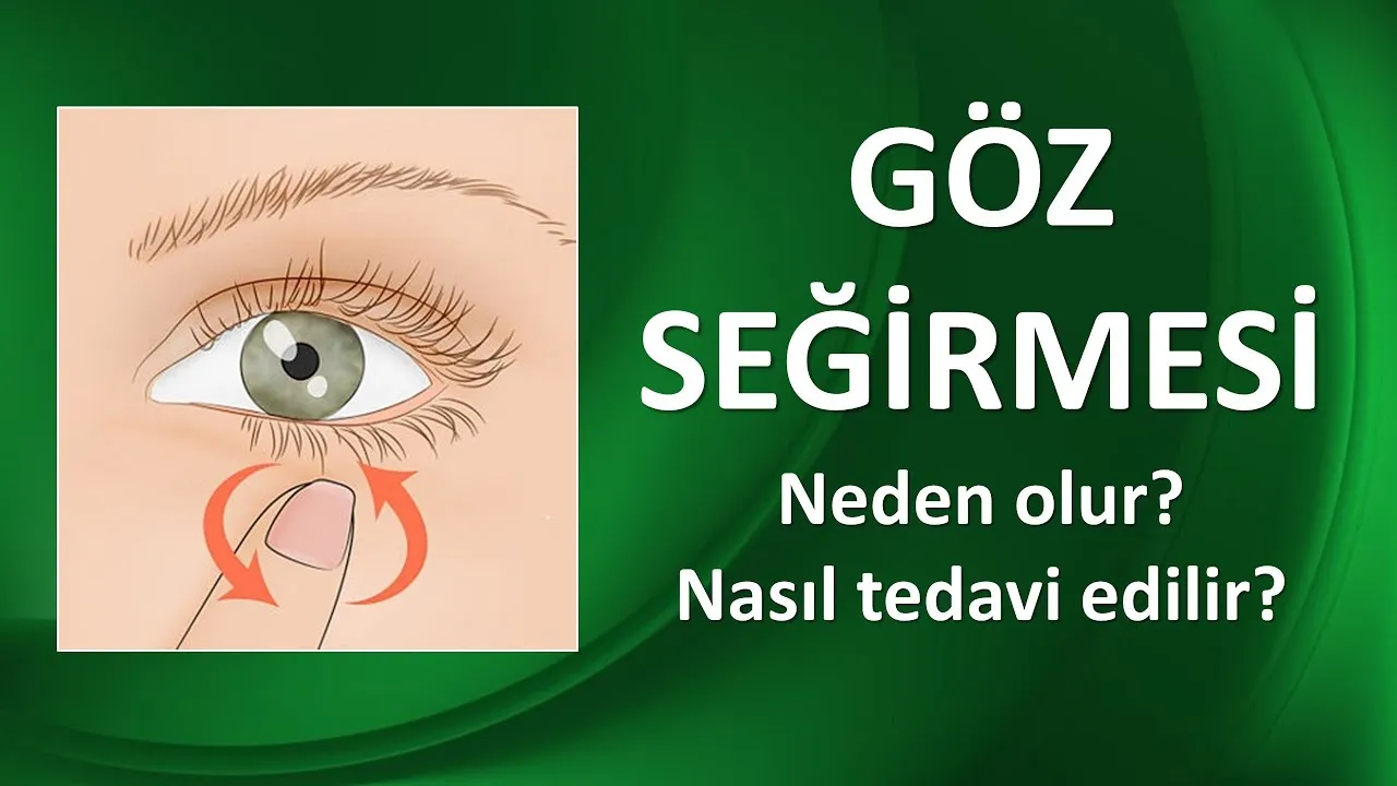 Göz Seyirmesi Neden Olur? Sebepleri, Tedavi Yöntemleri ve Korunma Önerileri